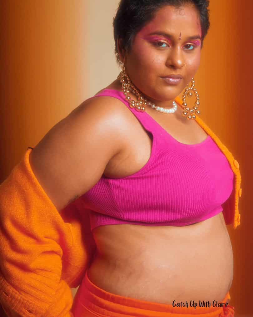 stretch mark removal